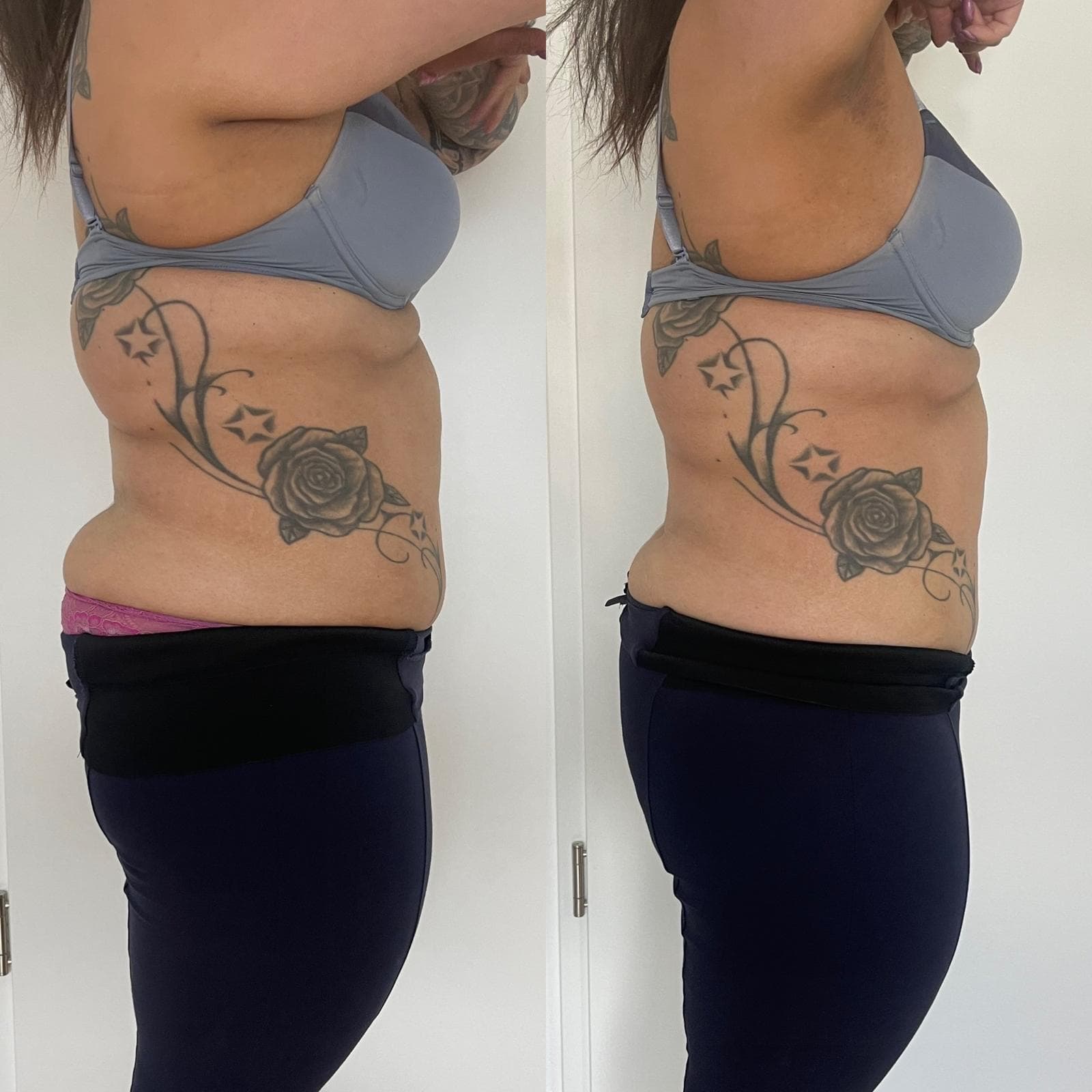 EMS Sculpter NEO München – Bodyshaping und Körpersculpting